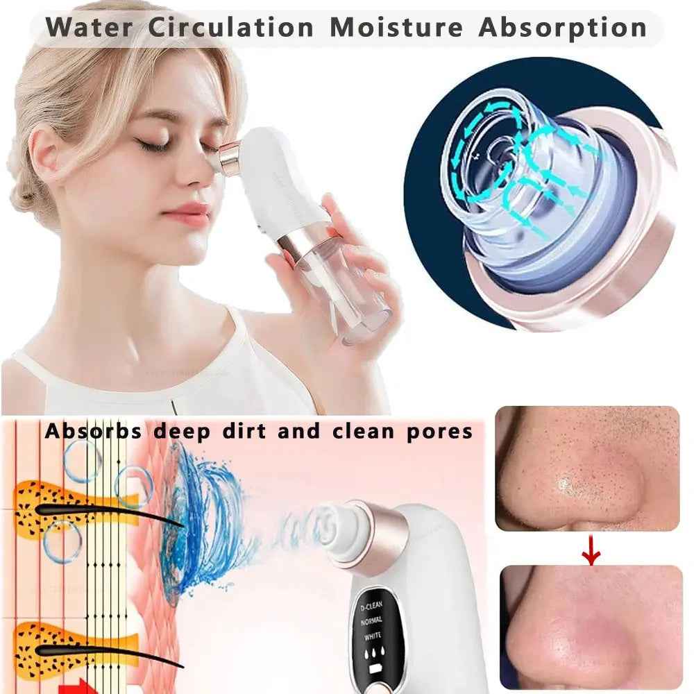 Blackhead Removal Tool for Skin Toning