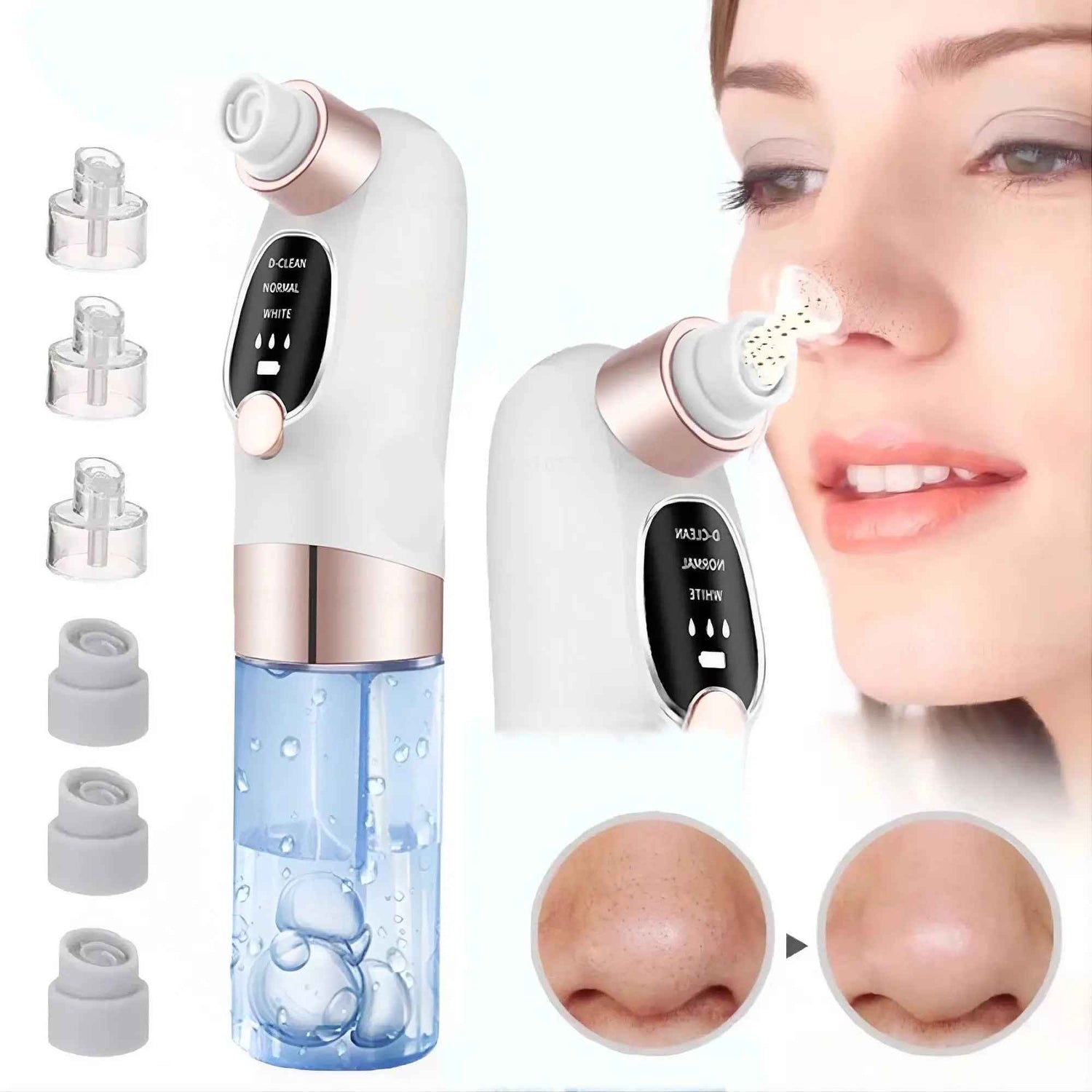 Blackhead Removal Tool for Skin Toningshop_this_look_amDhCa