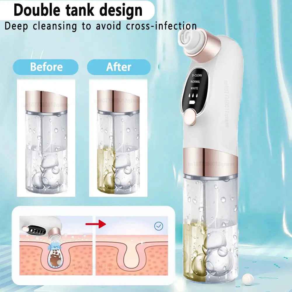 Blackhead Removal Tool for Skin Toning