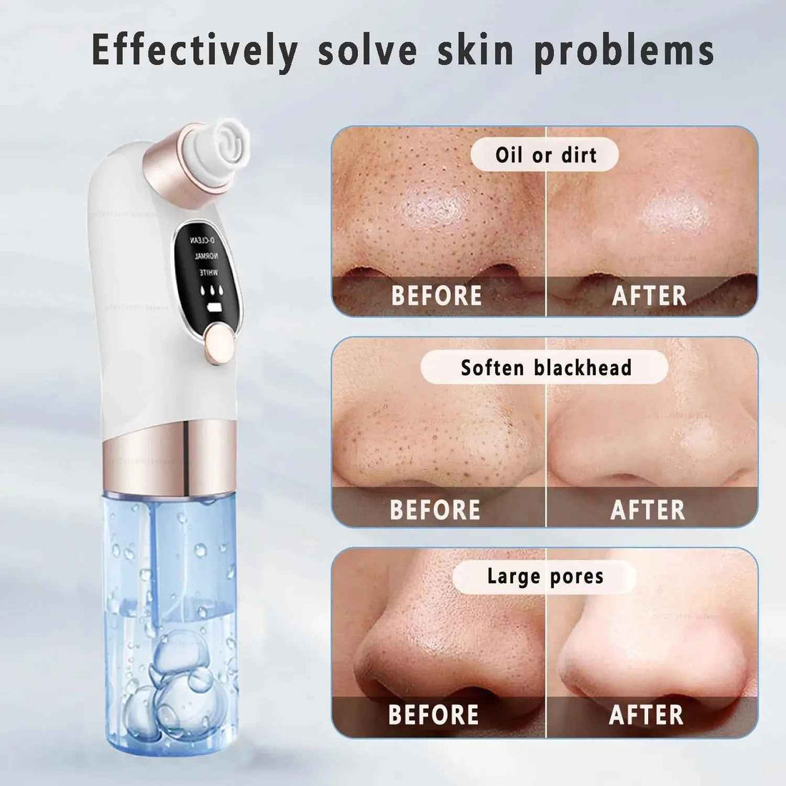 Blackhead Removal Tool for Skin Toning
